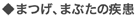 まつげ、まぶたの疾患